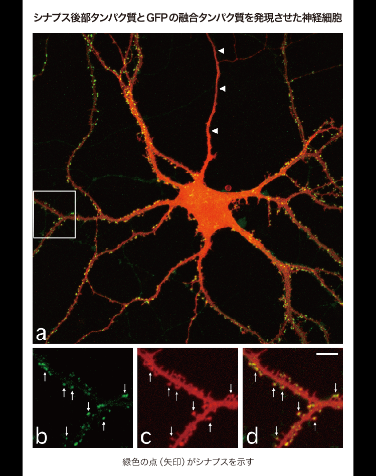 シナプス後部タンパク質とGFPの融合タンパク質を発現させた神経細胞